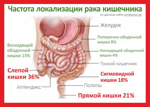 Новая методика диагностики заболеваний ЖКТ